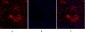 Ki-67 Polyclonal Antibody